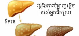 រលាក​ថ្លើម​ដោយ​សារ​ជាតិ​ពុលពី​ស្រា សំដៅ​លើ​ការ​រលាក​ថ្លើម​ដោយ​សារការផឹកស្រាជាប្រចាំ