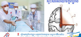 ជំងឺស្ទះសរសៃឈាមខួរក្បាលត្រូវការព្យាបាលបន្ទាន់បំផុត!