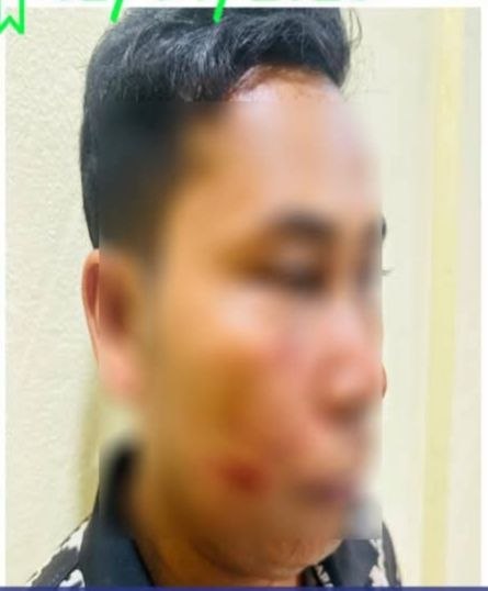 វត្ថុតាងដំបងឈើ