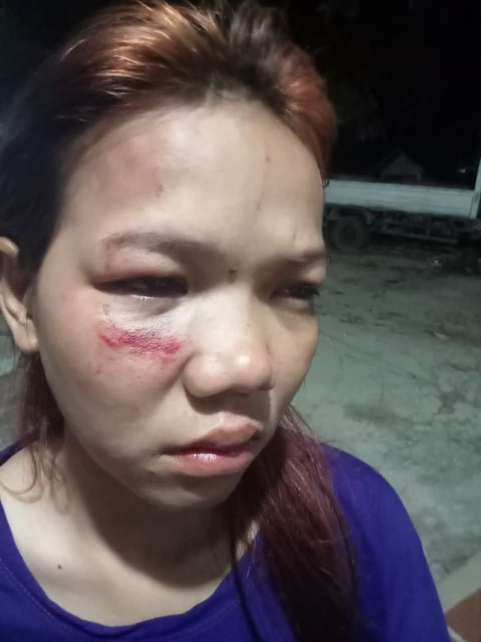ហិង្សាតាខ្មៅ